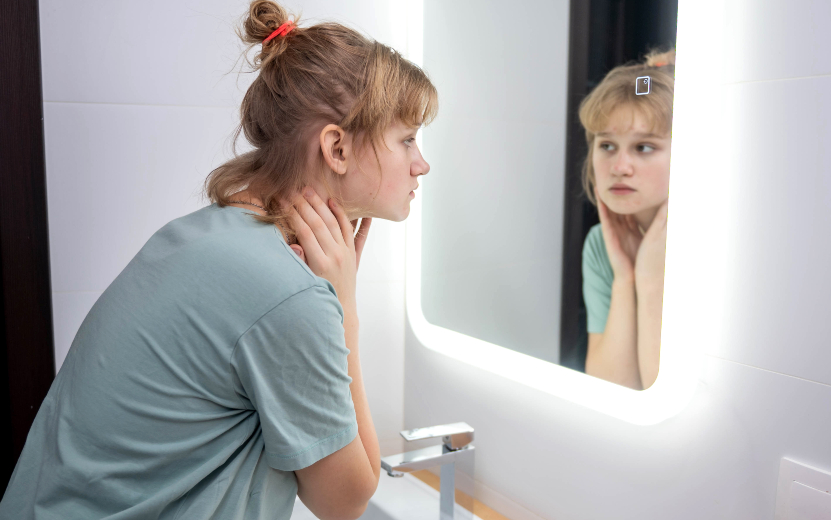 teen-girl-looks-in-the-mirror-at-problem-skin-2023-11-27-05-09-05-utc (1).jpg